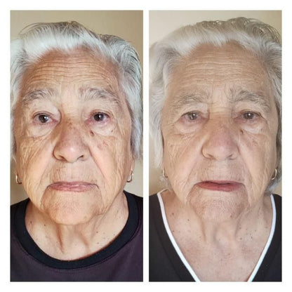 Rosa Mosqueta Amazónica 4 meses de tratamiento (30ml) 