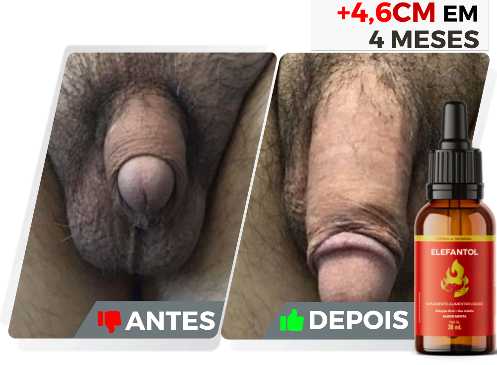 Elefantol tratamento de 3 meses