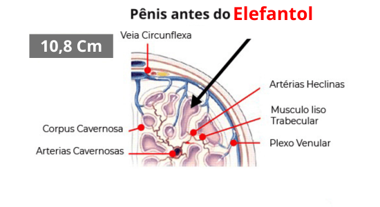 Elefantol tratamento de 1 mês
