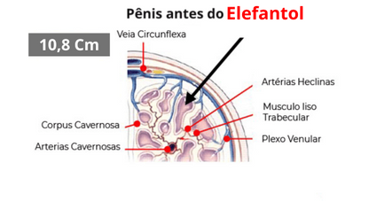 Elefantol tratamento de 1 mês