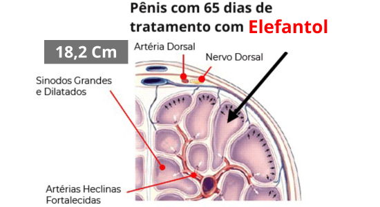 Elefantol tratamento de 1 mês