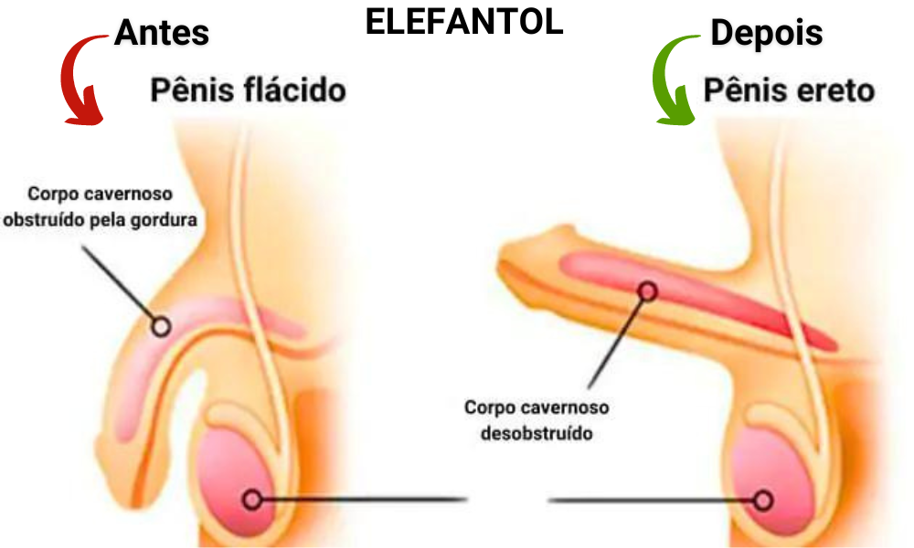 Elefantol tratamento de 1 mês