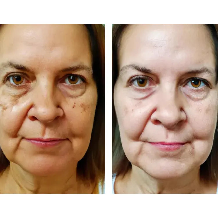 Rosa Mosqueta Amazónica 4 meses de tratamiento (30ml) 