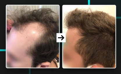 DHT BLOCKER 12 FRASCOS